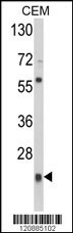 Western blot analysis of PRDX1 Antibody in CEM cell line lysates (35ug/lane)