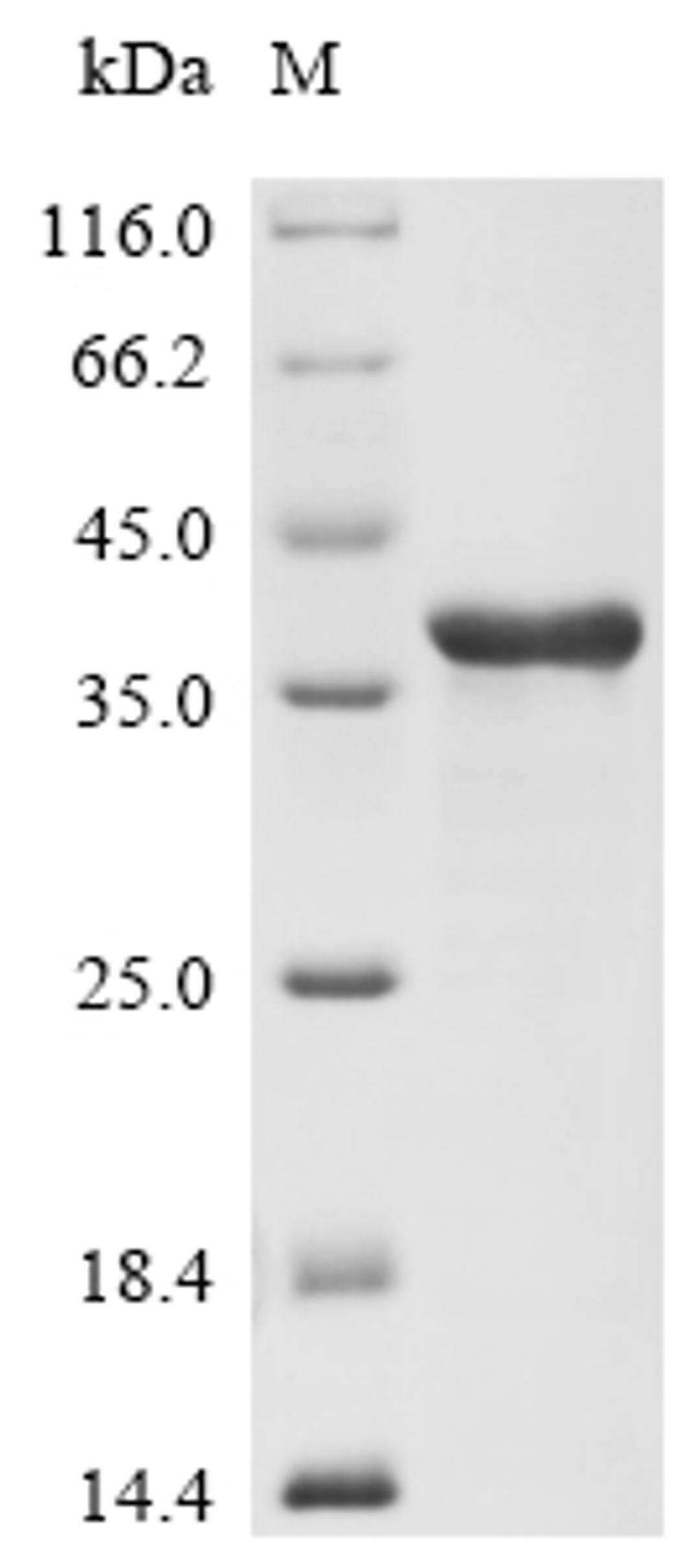(Tris-Glycine gel) Discontinuous SDS-PAGE (reduced) with 5% enrichment gel and 15% separation gel.