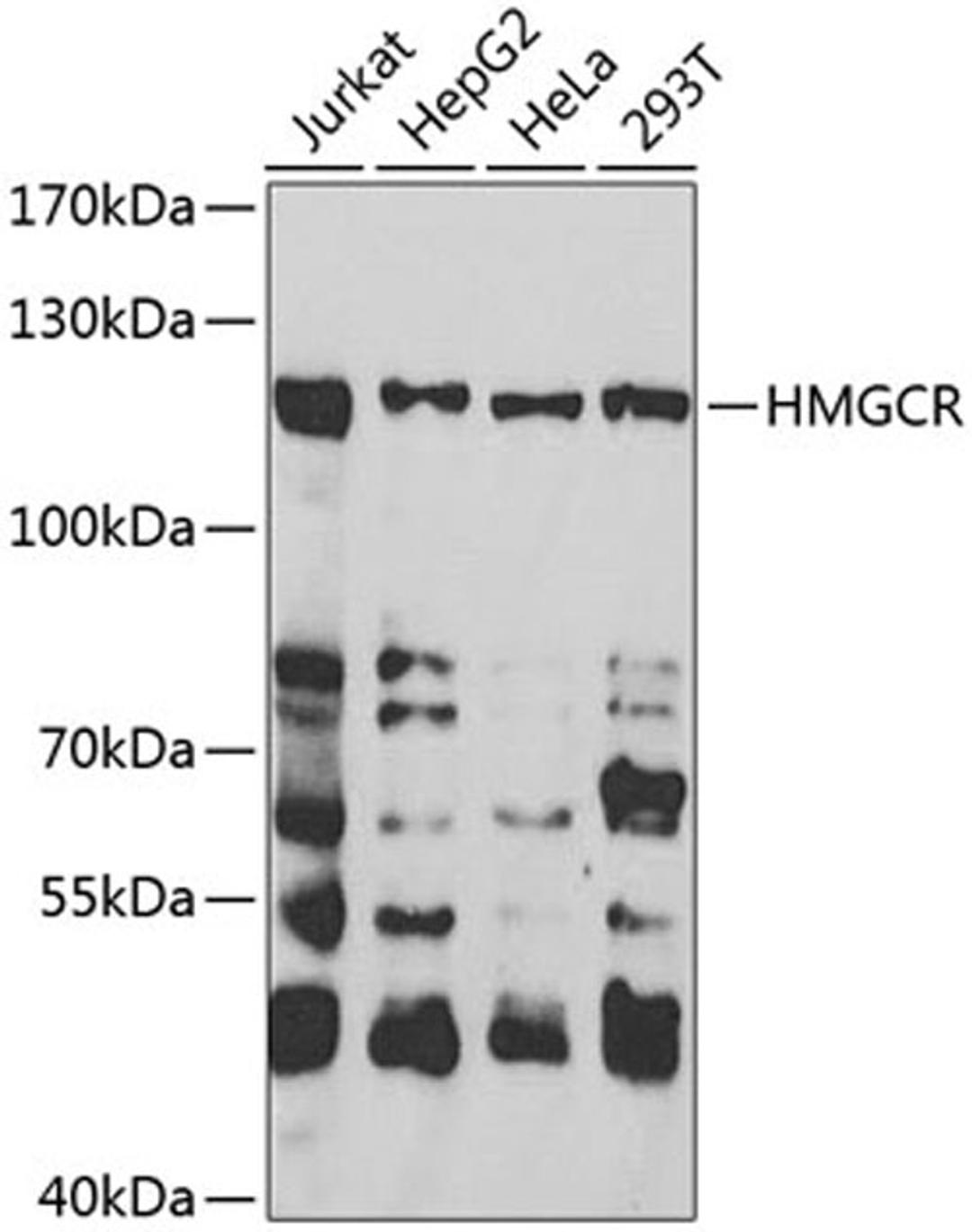 Western blot - HMGCR antibody (A13314)