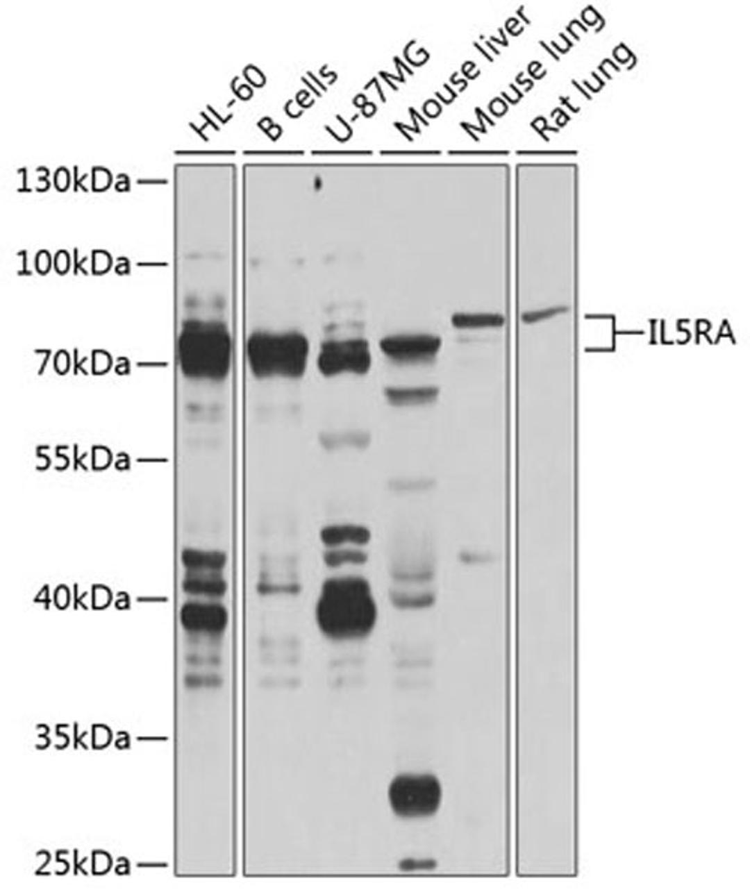 Western blot - IL5RA antibody (A8552)