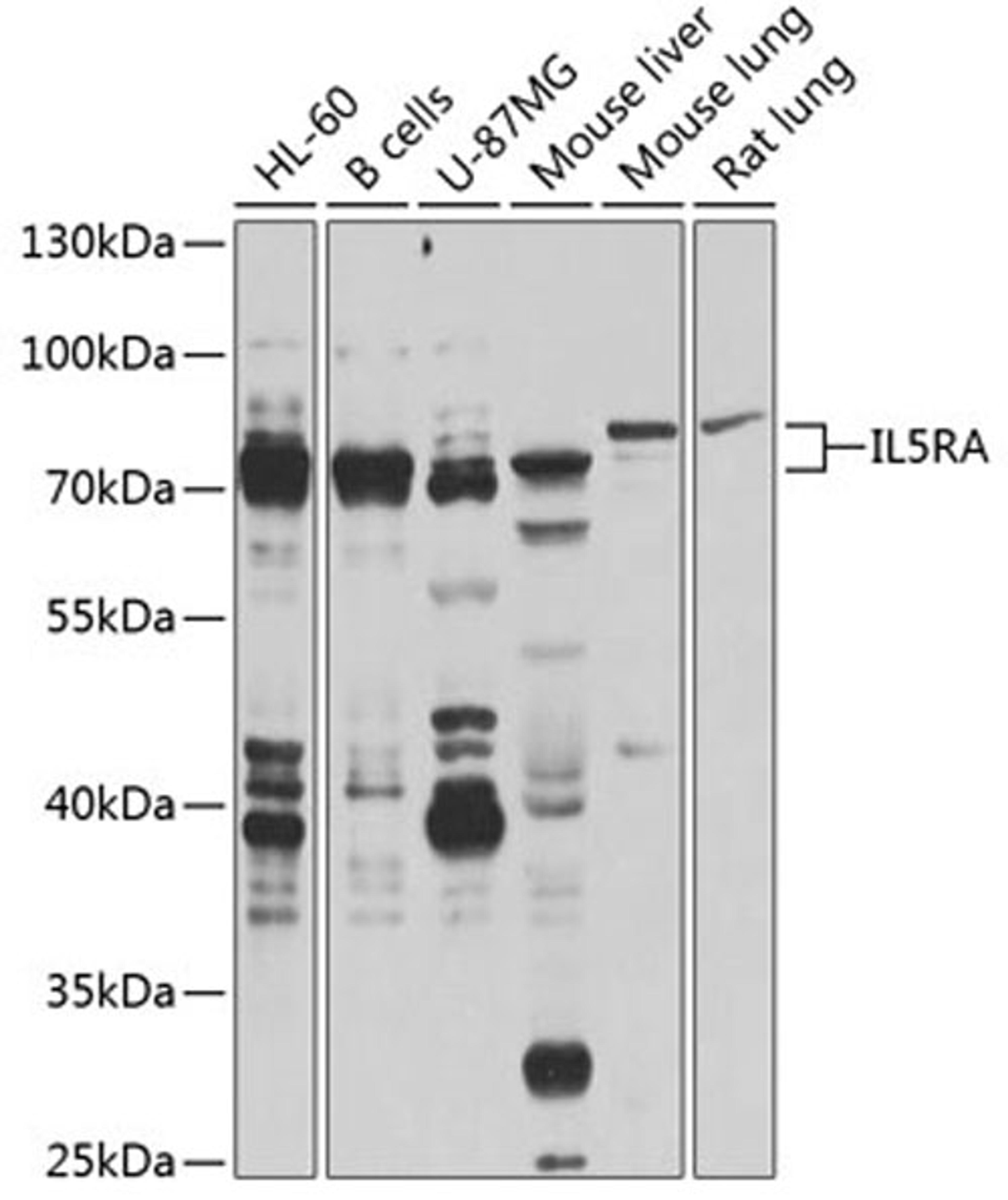 Western blot - IL5RA antibody (A8552)