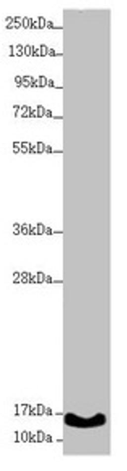 Western blot. All lanes: UQCC2 antibody at 1.74µg/ml + A431 whole cell lysate. Secondary. Goat polyclonal to rabbit IgG at 1/10000 dilution. Predicted band size: 15 kDa. Observed band size: 15 kDa