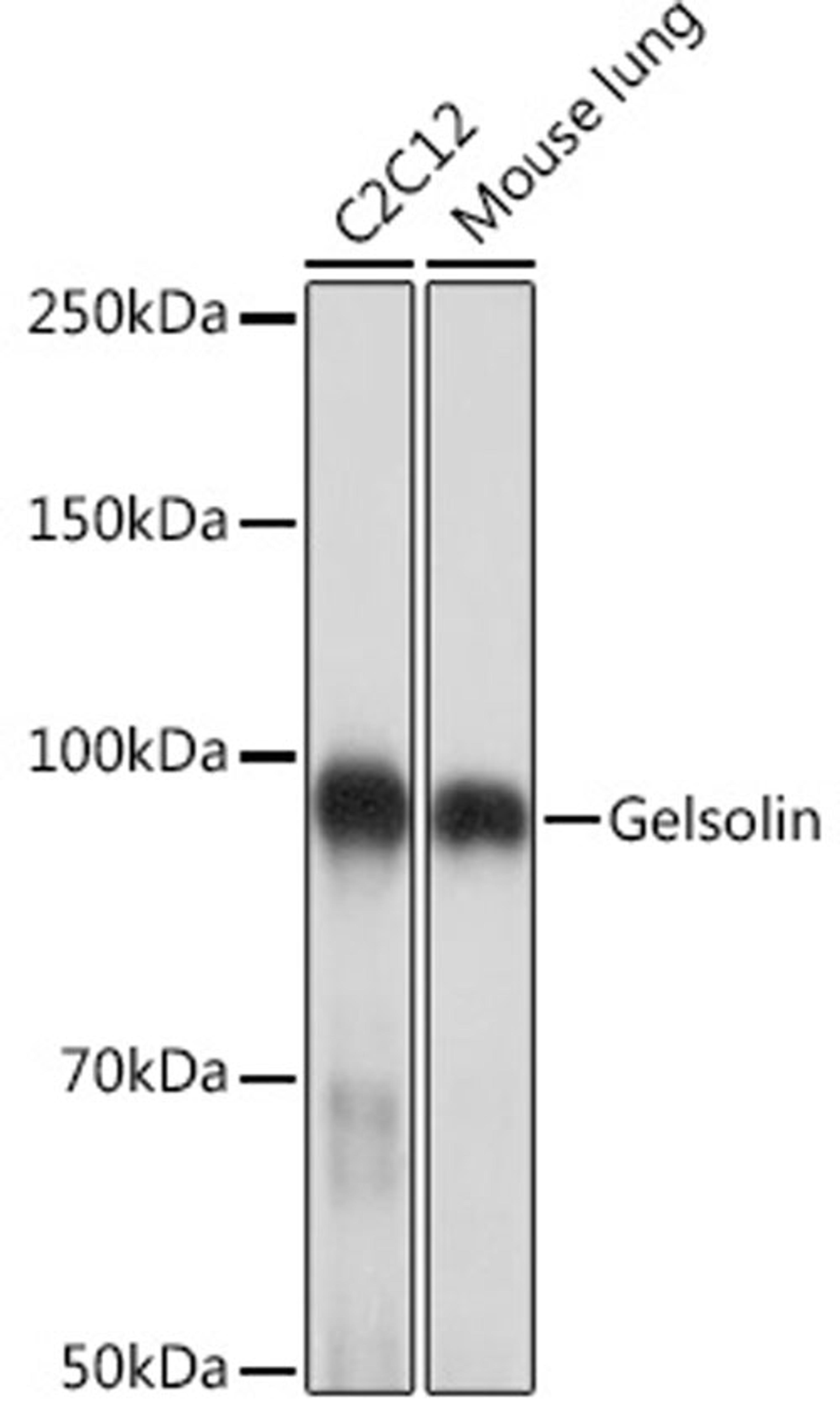 Western blot - Gelsolin Rabbit mAb (A2612)