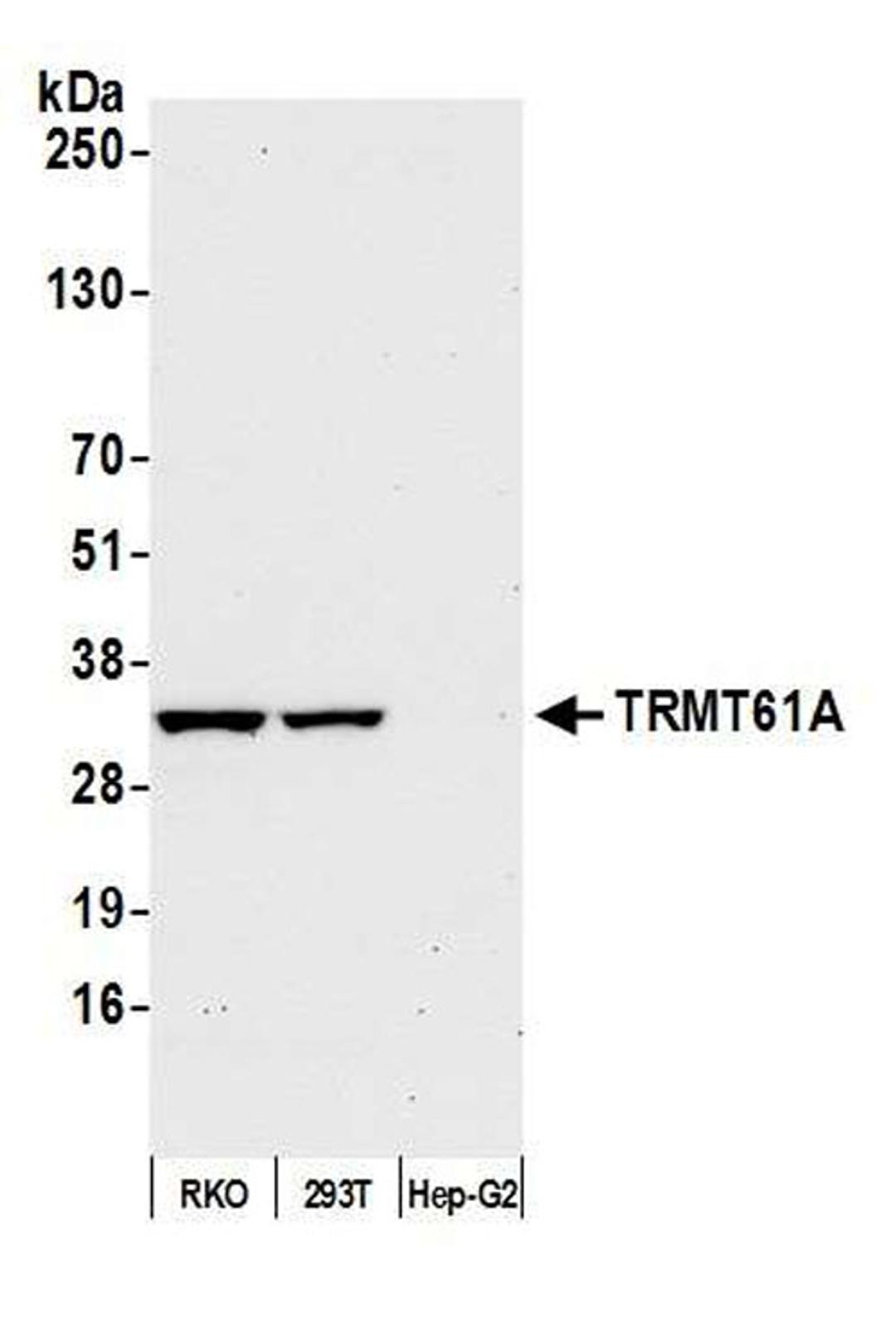 Detection of human TRMT61A by WB.