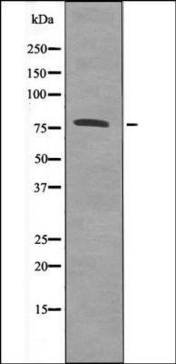 Western blot analysis of Insulin treated Jurkat whole cell lysates using Calpain 2 -Phospho-Ser50- antibody