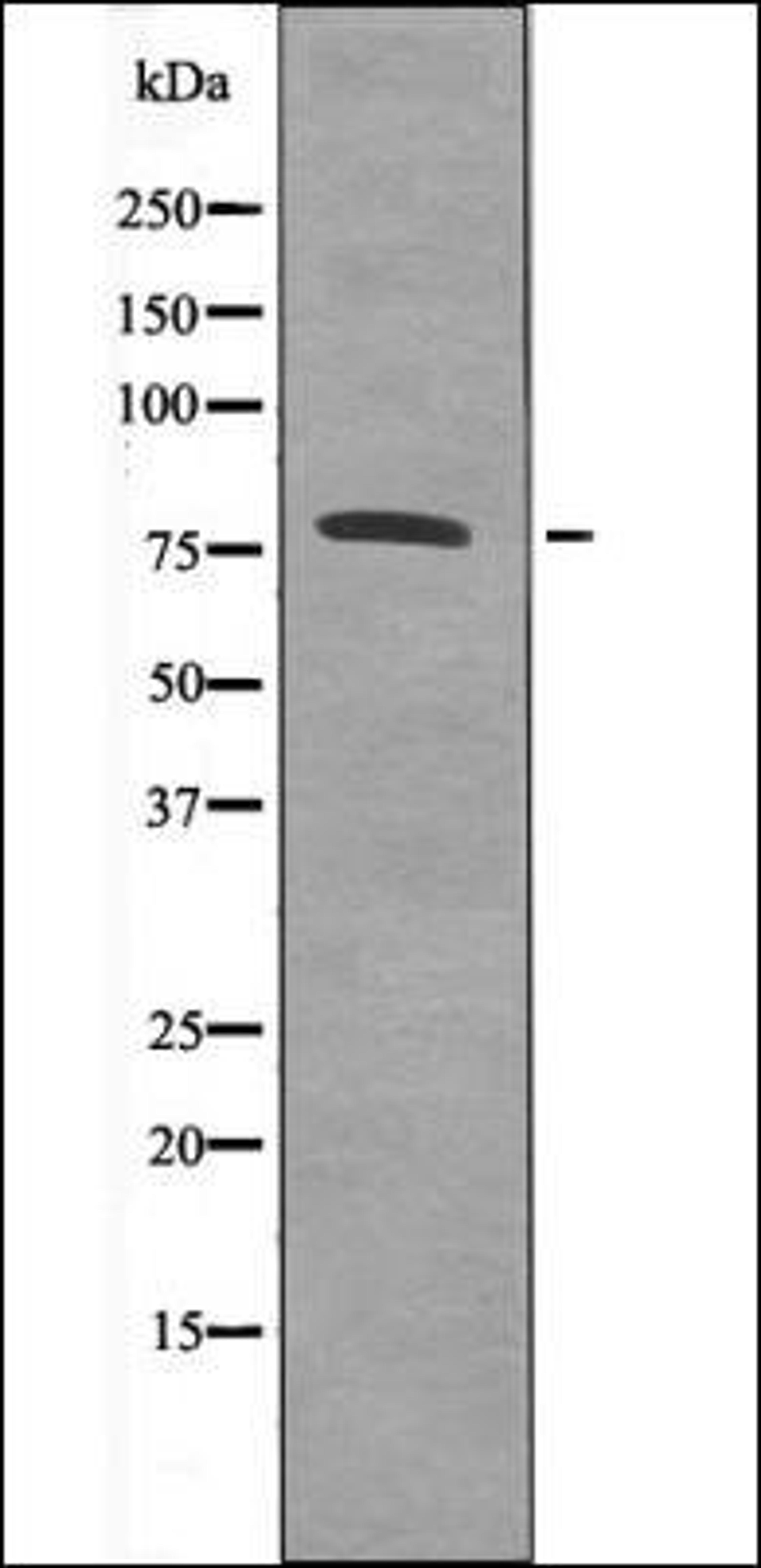 Western blot analysis of Insulin treated Jurkat whole cell lysates using Calpain 2 -Phospho-Ser50- antibody