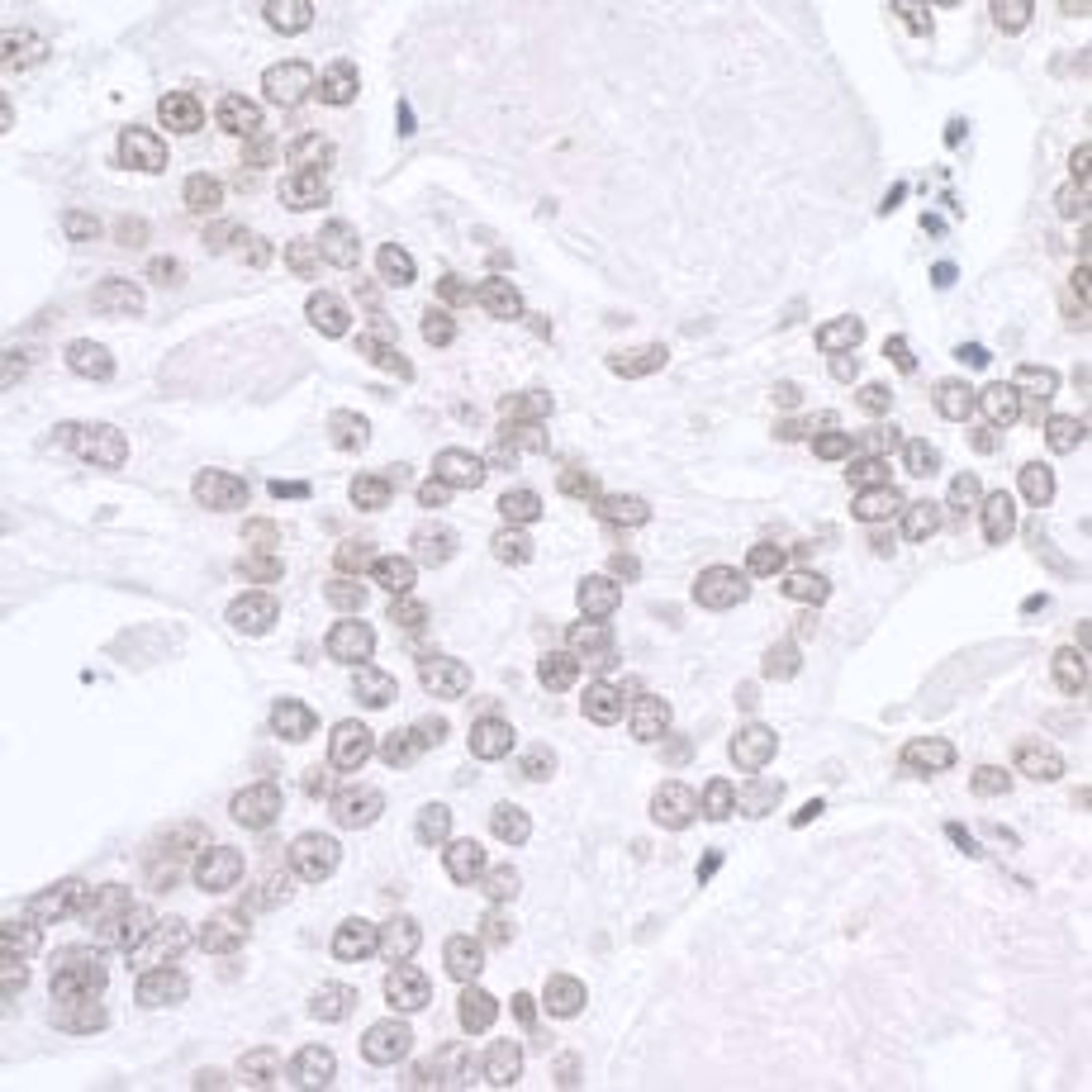 Detection of human SMARCA1/SNF2L by immunohistochemistry.