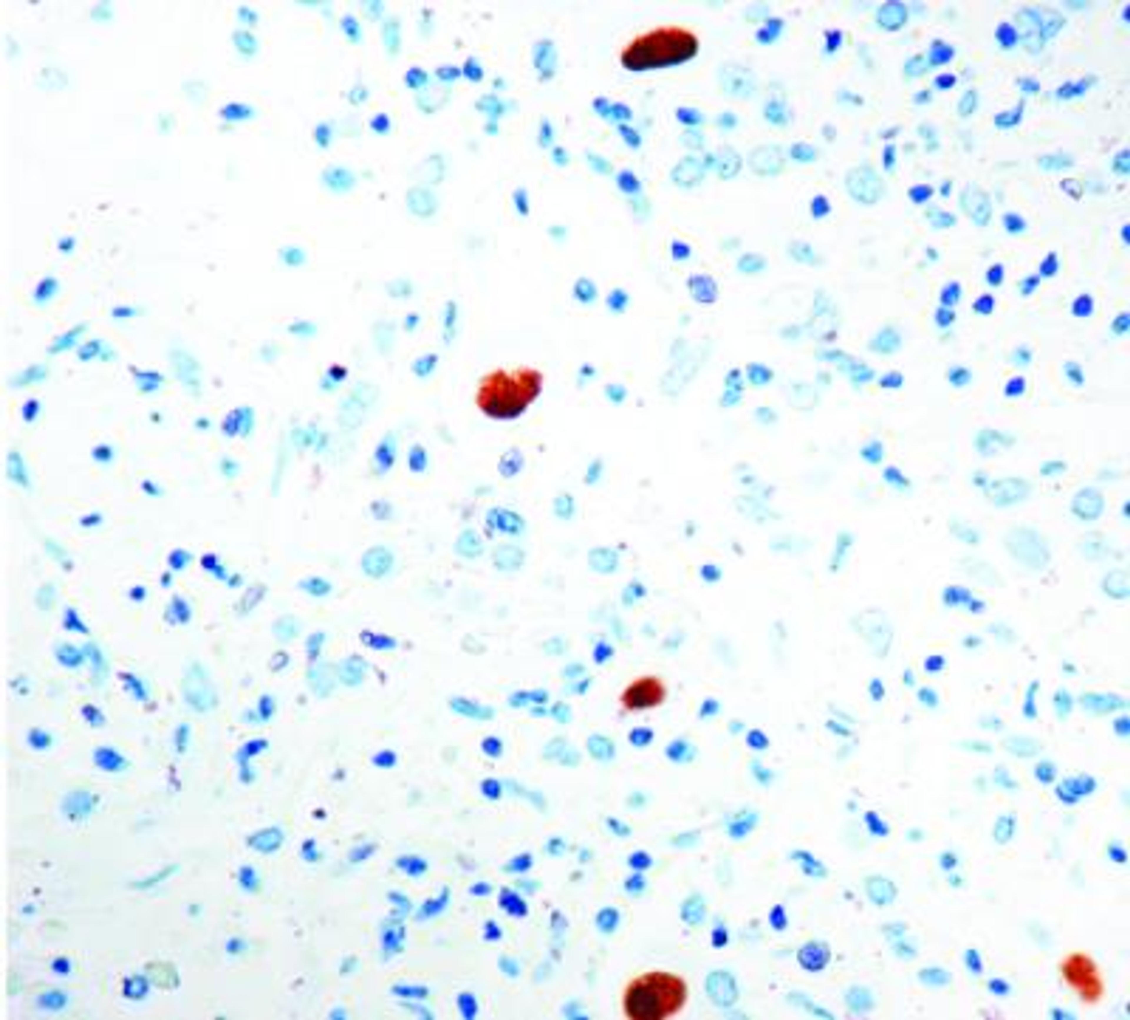 Immunohistochemistry-Paraffin: Cytomegalovirus Antibody (DDG9 and CCH2) [NBP1-22532] - Infected lung.