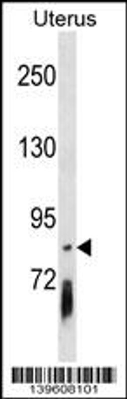 Western blot analysis in Uterus tissue lysates (35ug/lane).