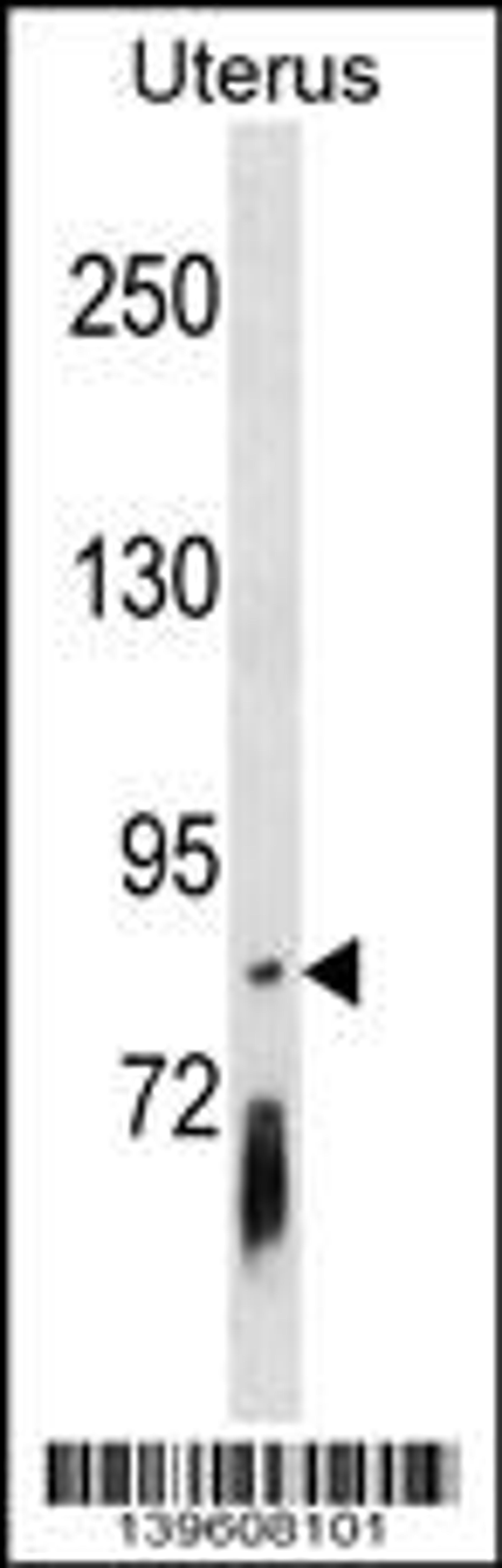 Western blot analysis in Uterus tissue lysates (35ug/lane).