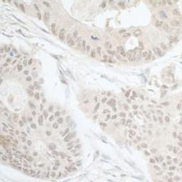 Detection of human DTL/CDT2 by immunohistochemistry. 