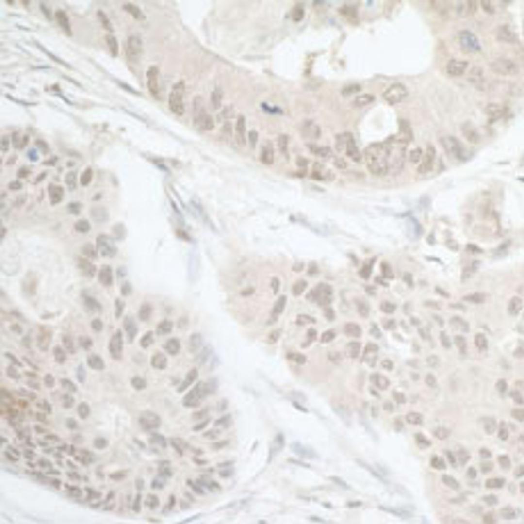 Detection of human DTL/CDT2 by immunohistochemistry.