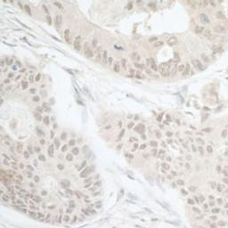 Detection of human DTL/CDT2 by immunohistochemistry.