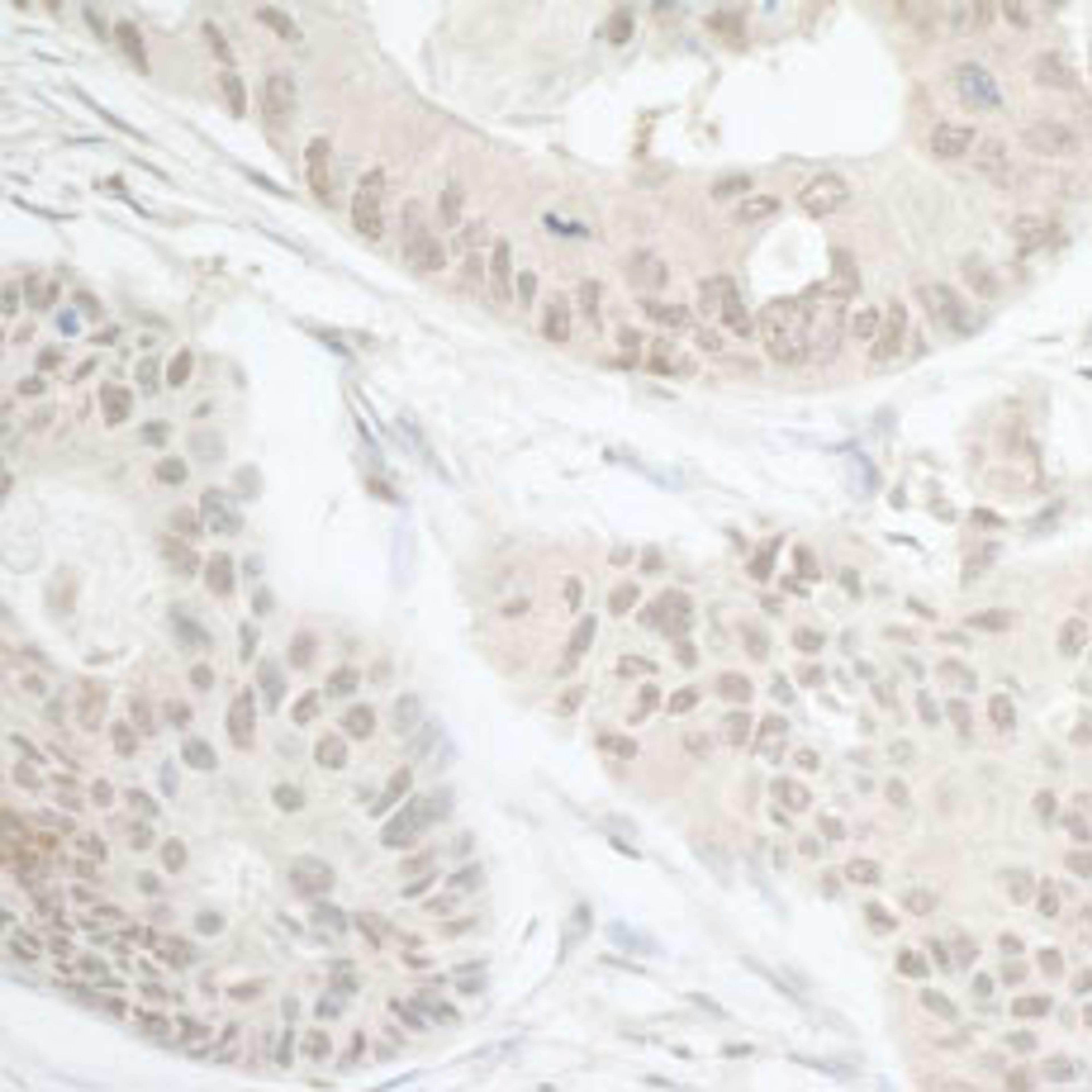 Detection of human DTL/CDT2 by immunohistochemistry.