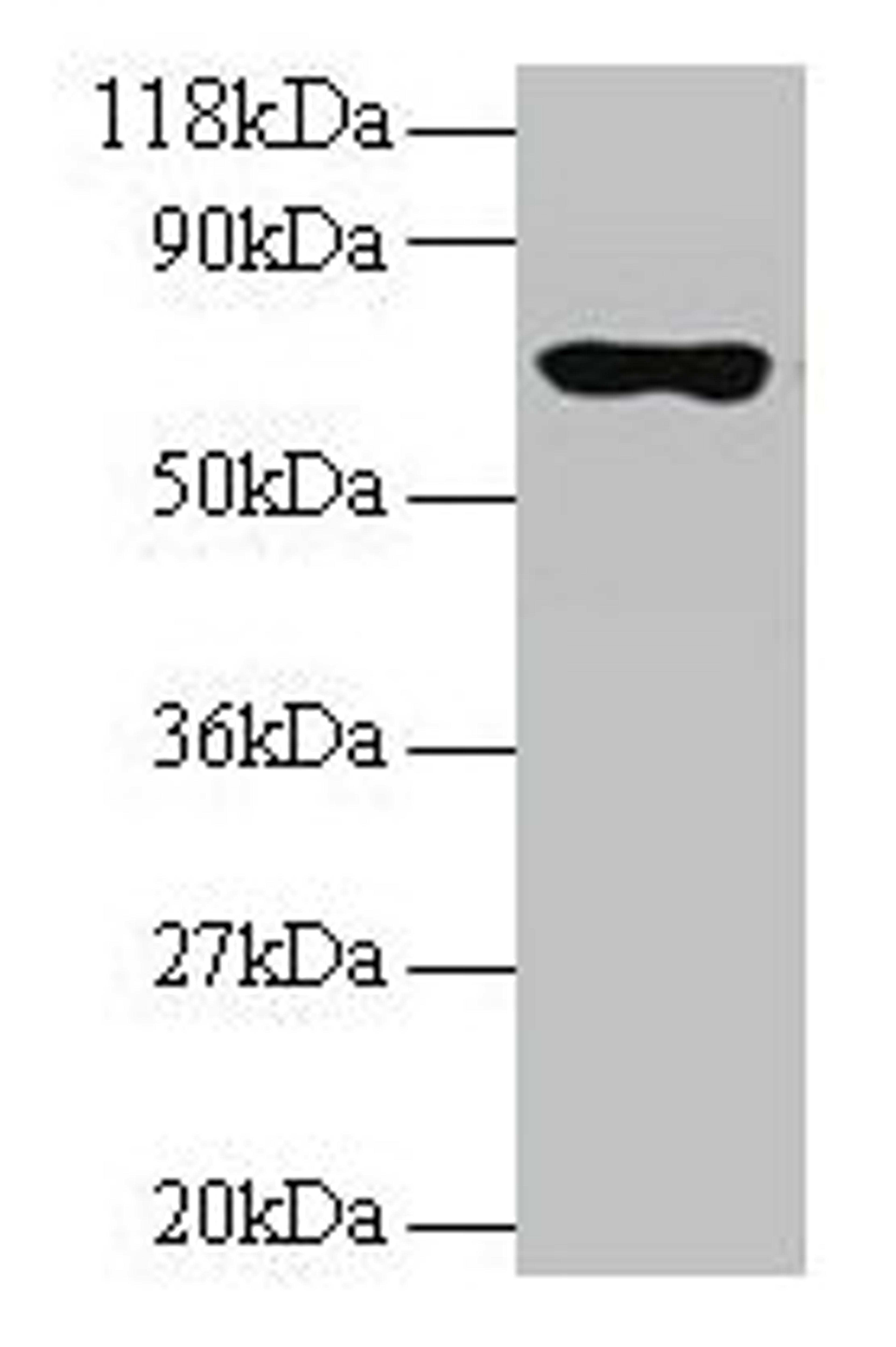 Western blot. All lanes: RPL15 antibody at 2µg/ml + 293T whole cell lysate. Secondary. Goat polyclonal to rabbit IgG at 1/15000 dilution. Predicted band size: 25, 17 kDa. Observed band size: 70 kDa