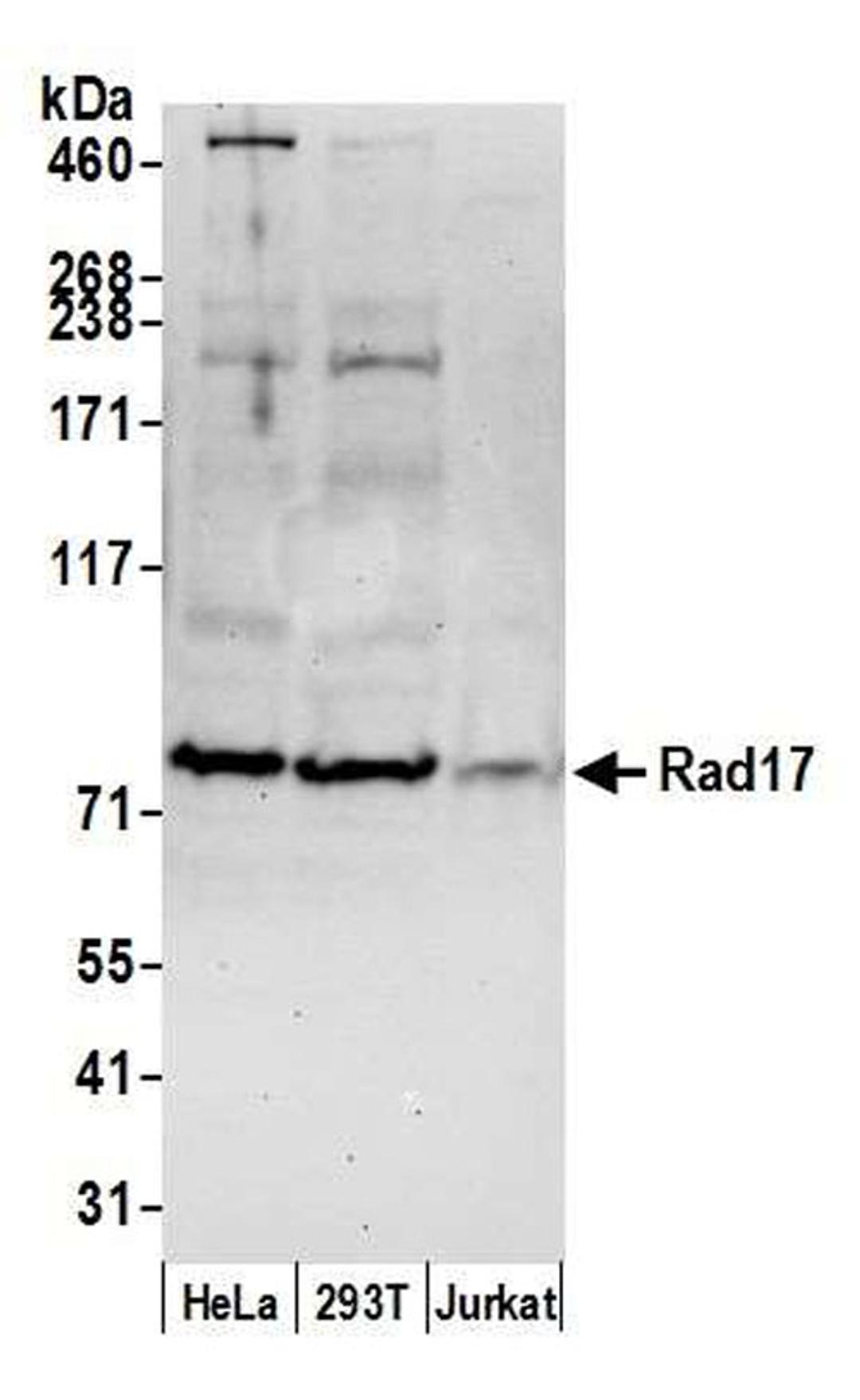 Detection of human Rad17 by WB.