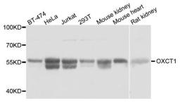 Western blot analysis of extracts of various cell lines using OXCT1 antibody