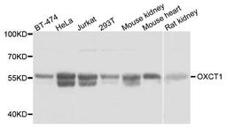 Western blot analysis of extracts of various cell lines using OXCT1 antibody
