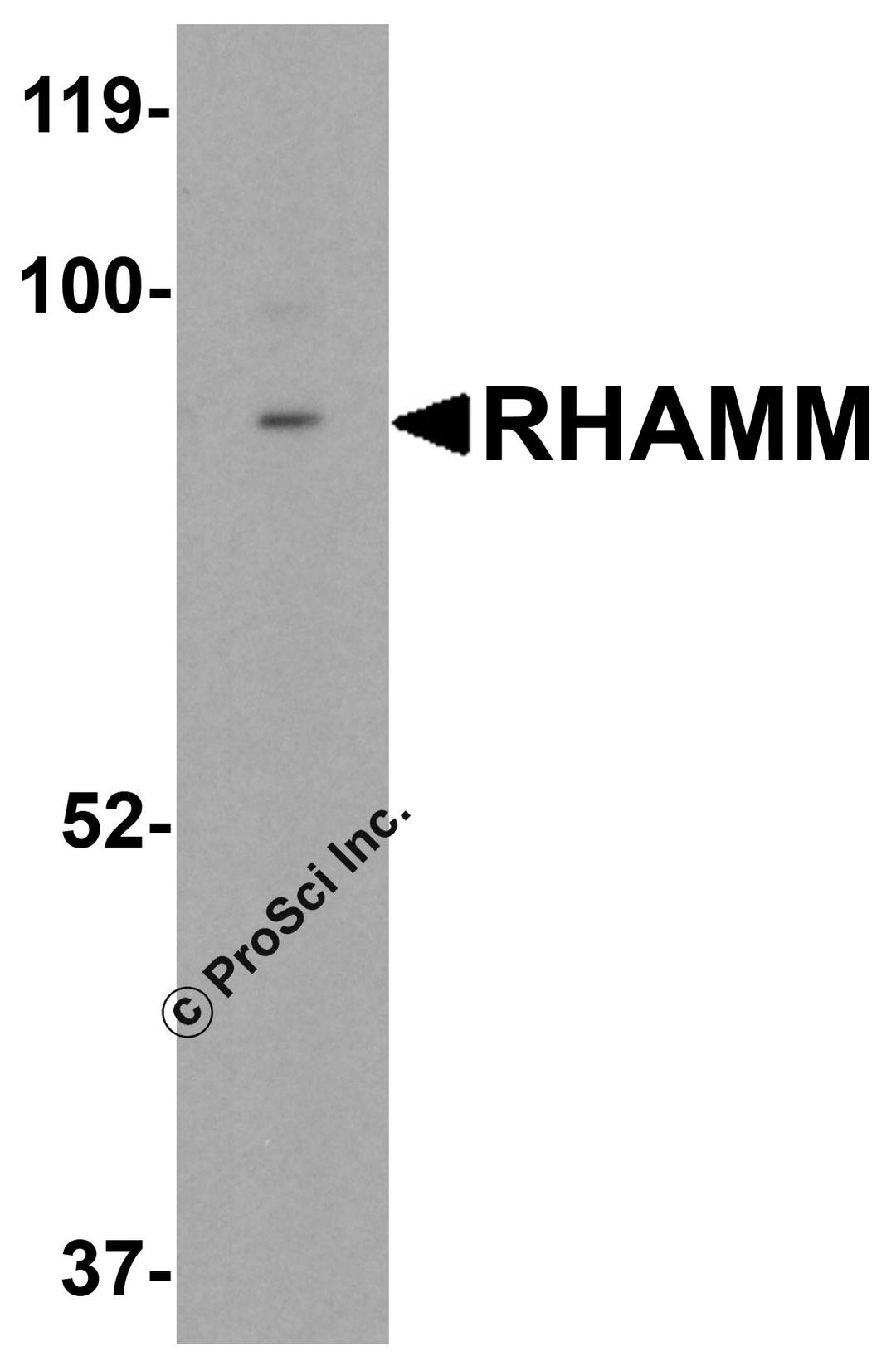Western blot analysis of RHAMM in rat stomach tissue lysate with RHAMM antibody at 0.5 μg/mL.