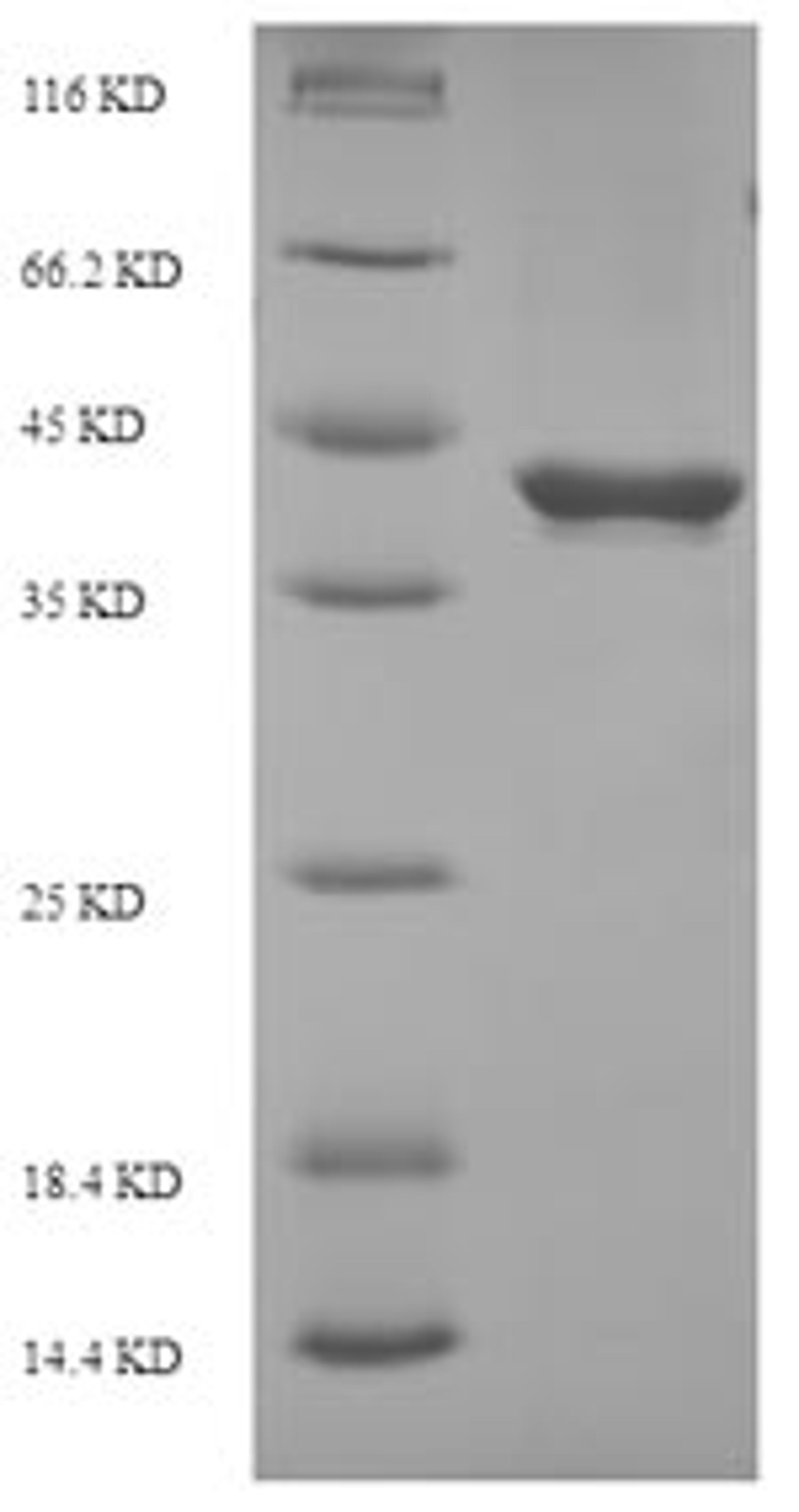 (Tris-Glycine gel) Discontinuous SDS-PAGE (reduced) with 5% enrichment gel and 15% separation gel.