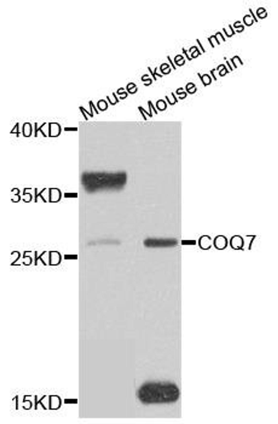 Western blot analysis of extracts of mouse testis using COQ7 antibody