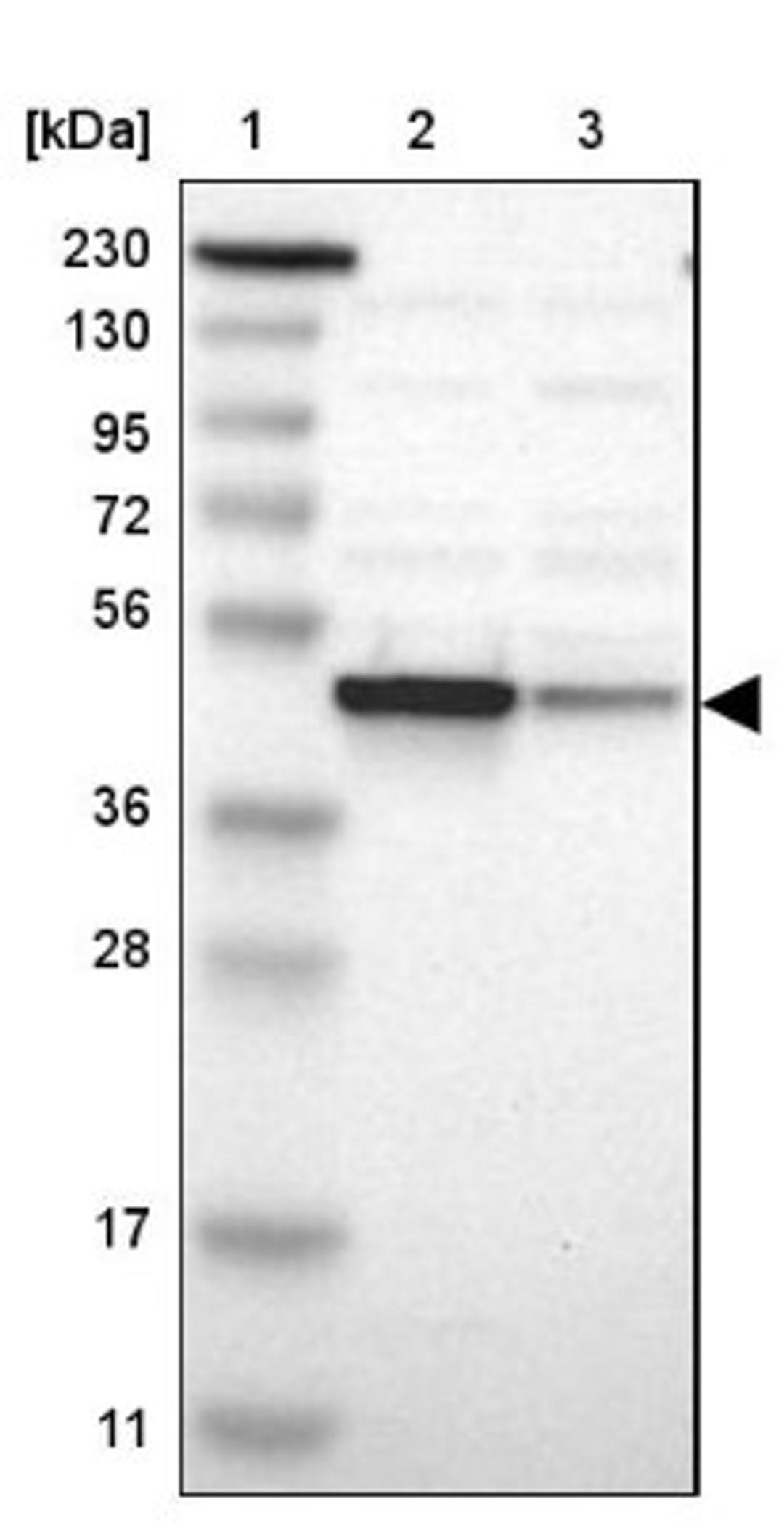 Western Blot: NDRG1 Antibody [NBP1-86636] - Lane 1: Marker [kDa] 230, 130, 95, 72, 56, 36, 28, 17, 11<br/>Lane 2: Human cell line RT-4<br/>Lane 3: Human cell line U-251MG sp