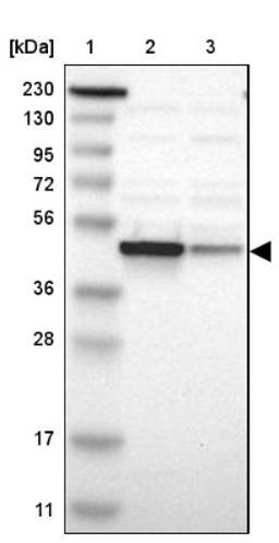 Western Blot: NDRG1 Antibody [NBP1-86636] - Lane 1: Marker [kDa] 230, 130, 95, 72, 56, 36, 28, 17, 11<br/>Lane 2: Human cell line RT-4<br/>Lane 3: Human cell line U-251MG sp