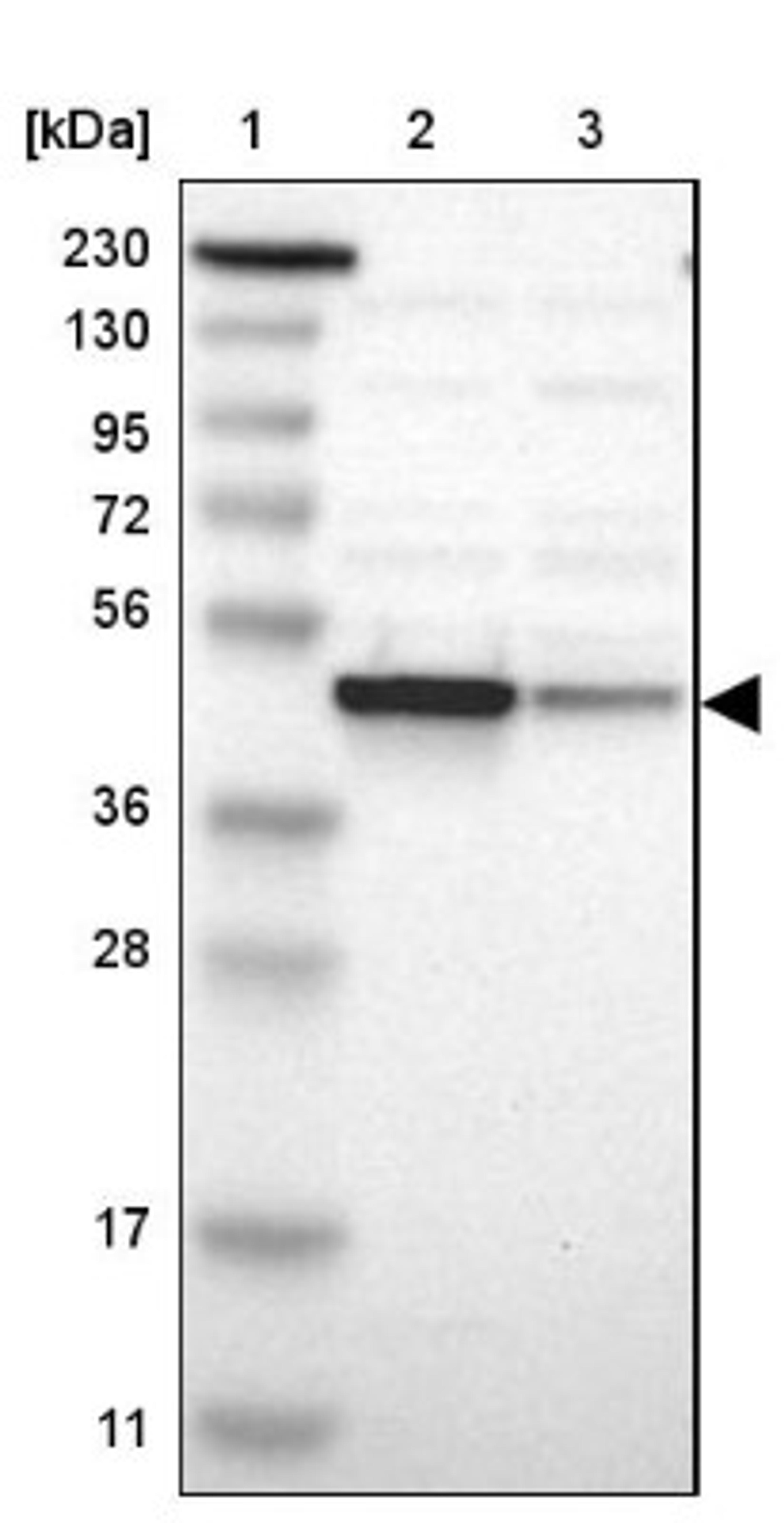 Western Blot: NDRG1 Antibody [NBP1-86636] - Lane 1: Marker [kDa] 230, 130, 95, 72, 56, 36, 28, 17, 11<br/>Lane 2: Human cell line RT-4<br/>Lane 3: Human cell line U-251MG sp