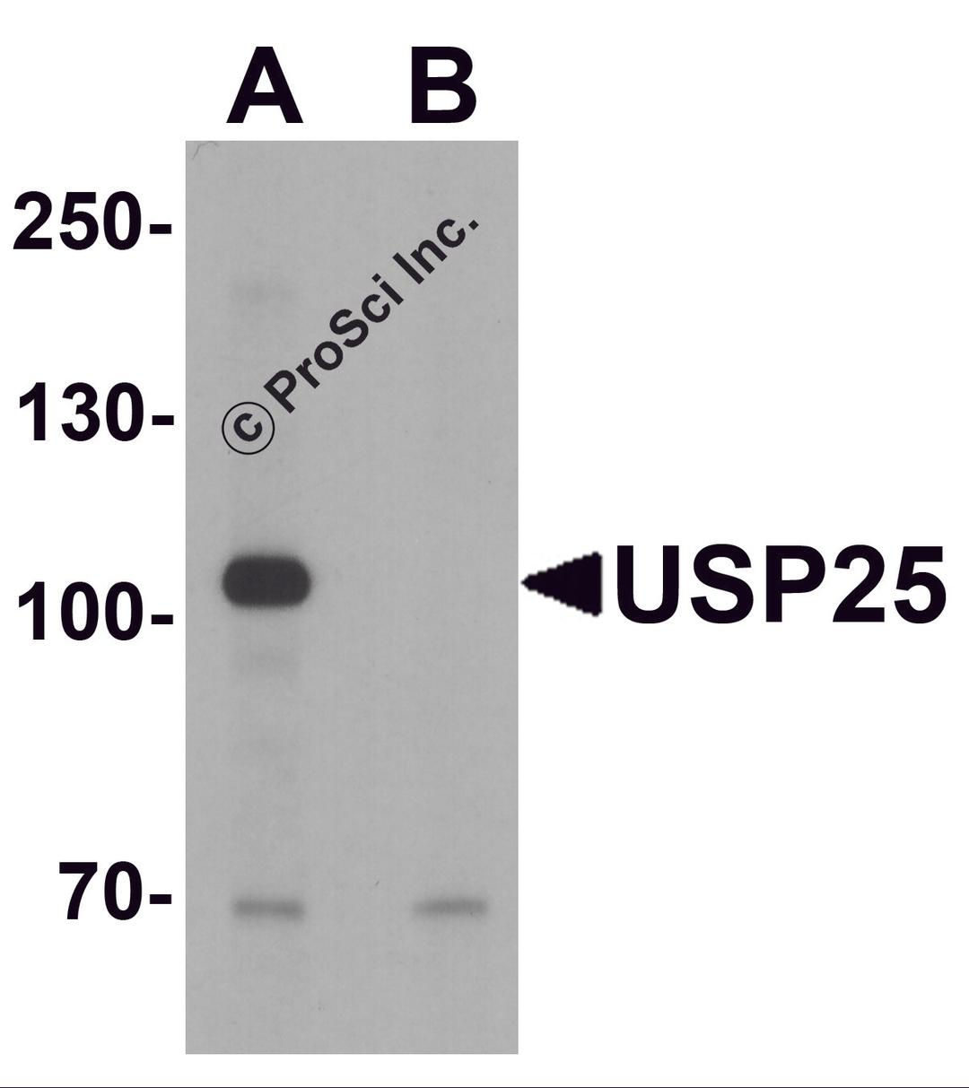 Western blot analysis of USP25 in mouse brain tissue lysate with USP25 antibody at 1 μg/ml in (A) the absence and (B) the presence of blocking peptide.