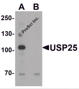 Western blot analysis of USP25 in mouse brain tissue lysate with USP25 antibody at 1 μg/ml in (A) the absence and (B) the presence of blocking peptide.