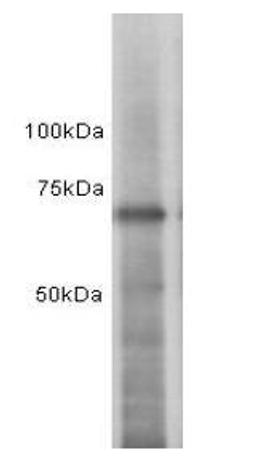 Western Blot analysis of MCF-7 using Estrogen Receptor 1 antibody