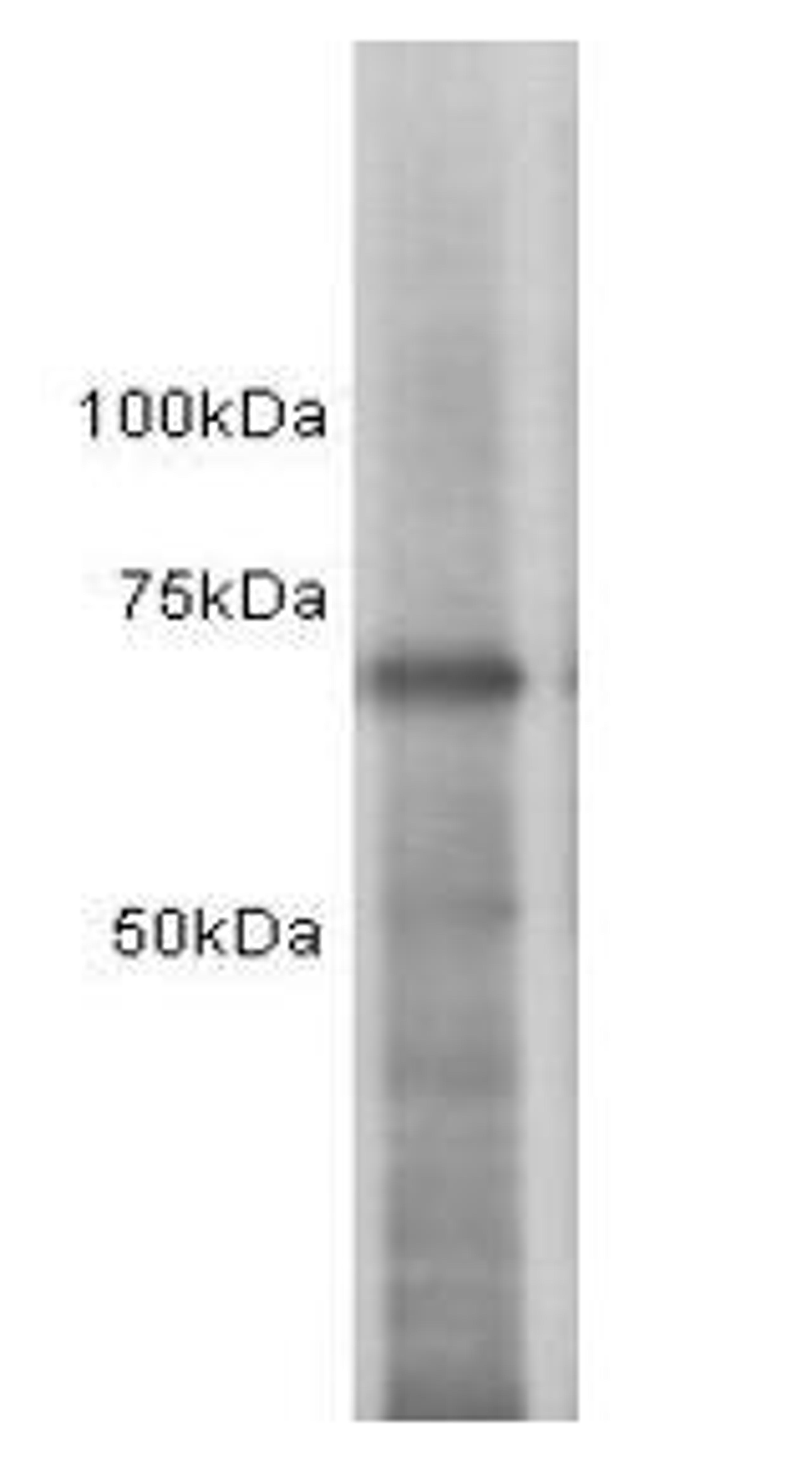 Western Blot analysis of MCF-7 using Estrogen Receptor 1 antibody