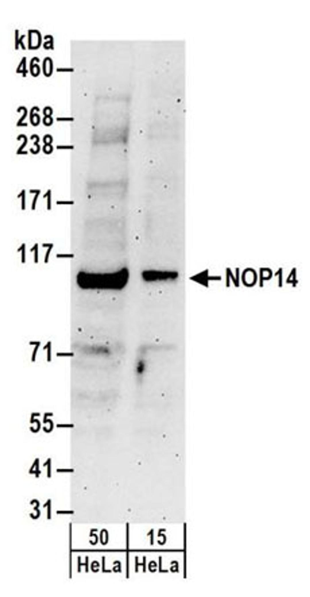 Detection of human NOP14 by western blot.