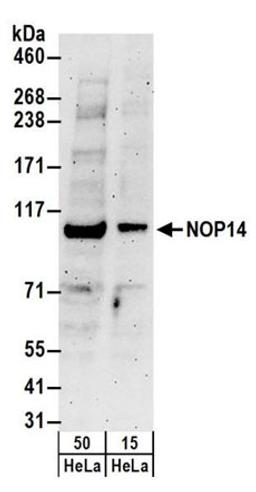 Detection of human NOP14 by western blot.