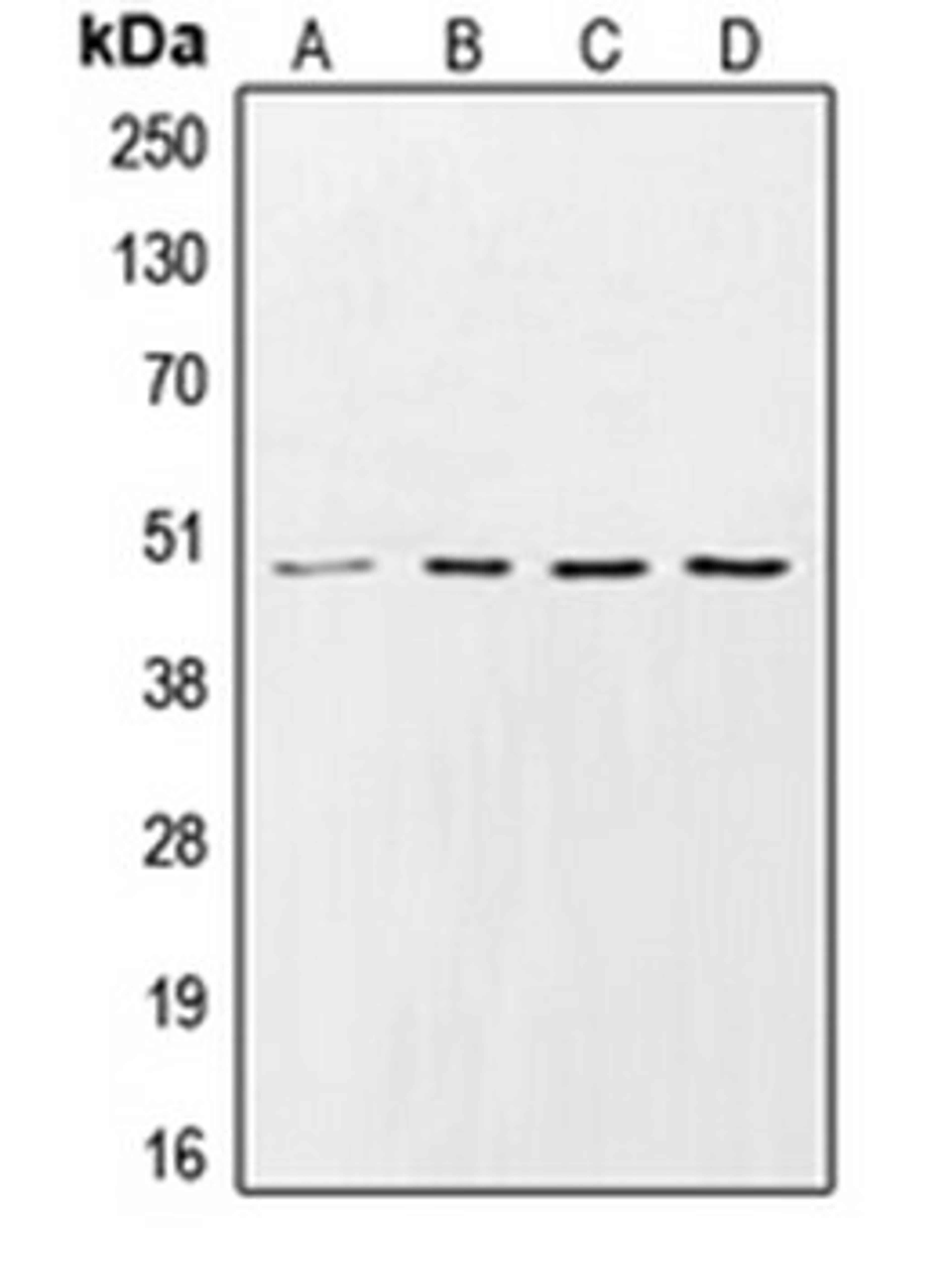 Western blot analysis of HeLa (Lane 1), Raw264.7 (Lane 2), PC12 (Lane 3), rat heart (Lane 4) whole cell lysates using CSNK1G2 antibody