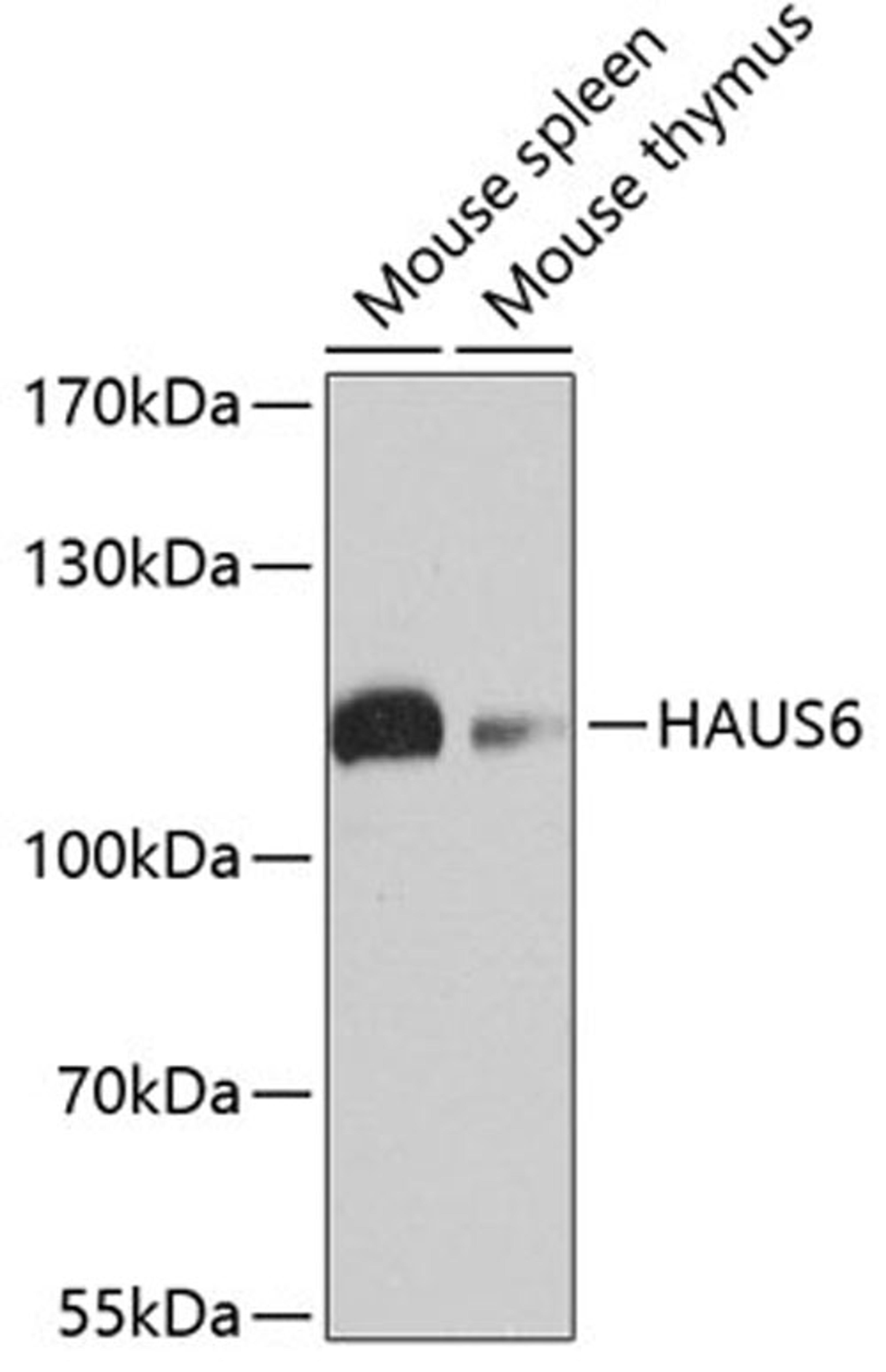 Western blot - HAUS6 antibody (A4797)