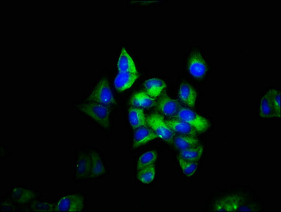 Immunofluorescence staining of Hela cells with CSB-PA05189A0Rb at 1:133, counter-stained with DAPI. The cells were fixed in 4% formaldehyde, permeabilized using 0.2% Triton X-100 and blocked in 10% normal Goat Serum. The cells were then incubated with the antibody overnight at 4°C. The secondary antibody was Alexa Fluor 488-congugated AffiniPure Goat Anti-Rabbit IgG(H+L).