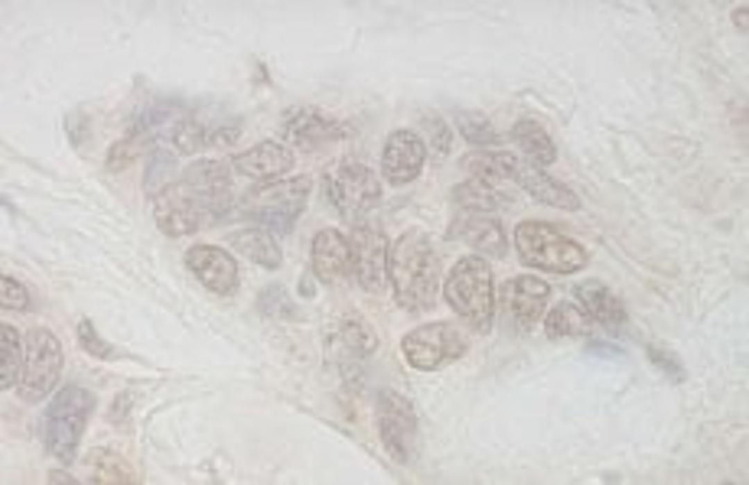 Detection of human IBP160 by immunohistochemistry.