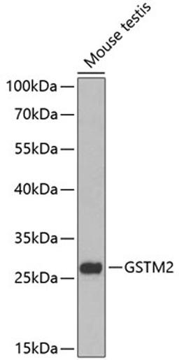 Western blot - GSTM2 antibody (A13496)