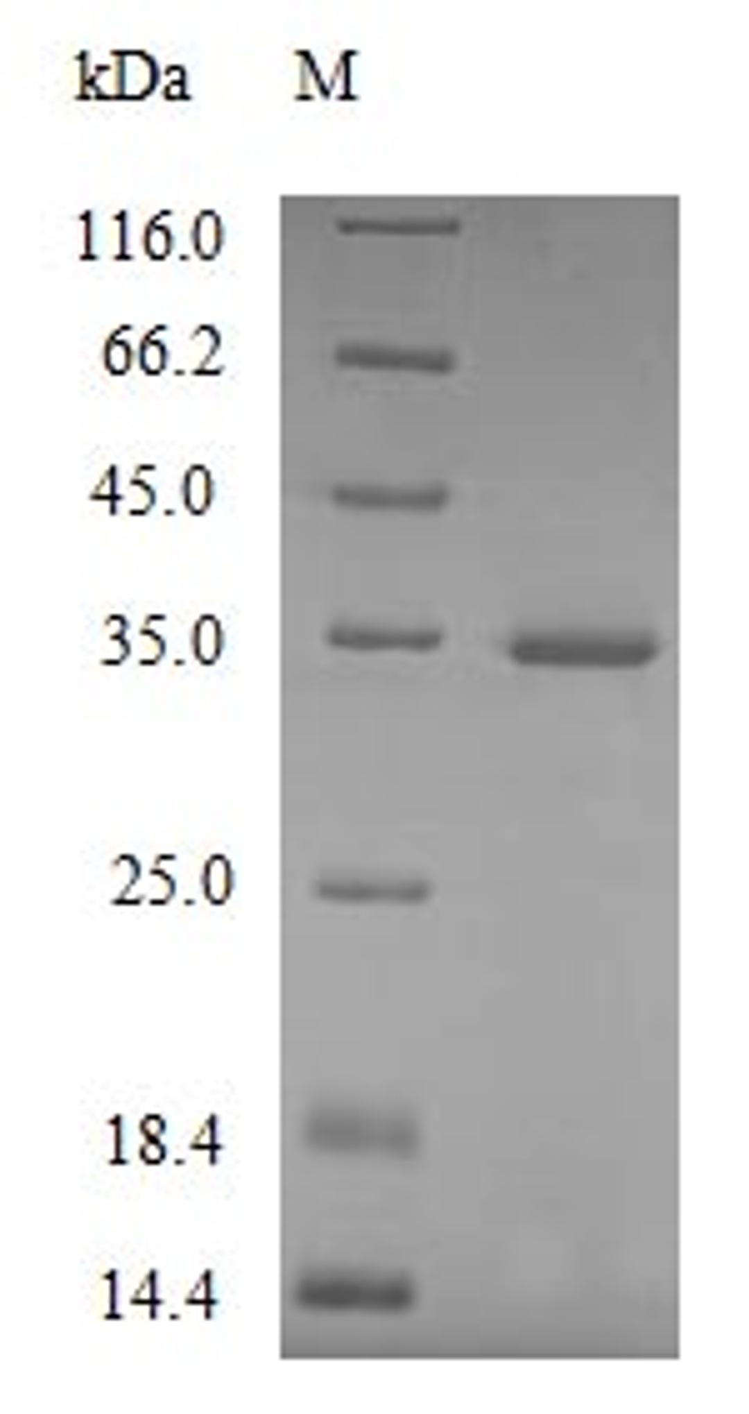 (Tris-Glycine gel) Discontinuous SDS-PAGE (reduced) with 5% enrichment gel and 15% separation gel.