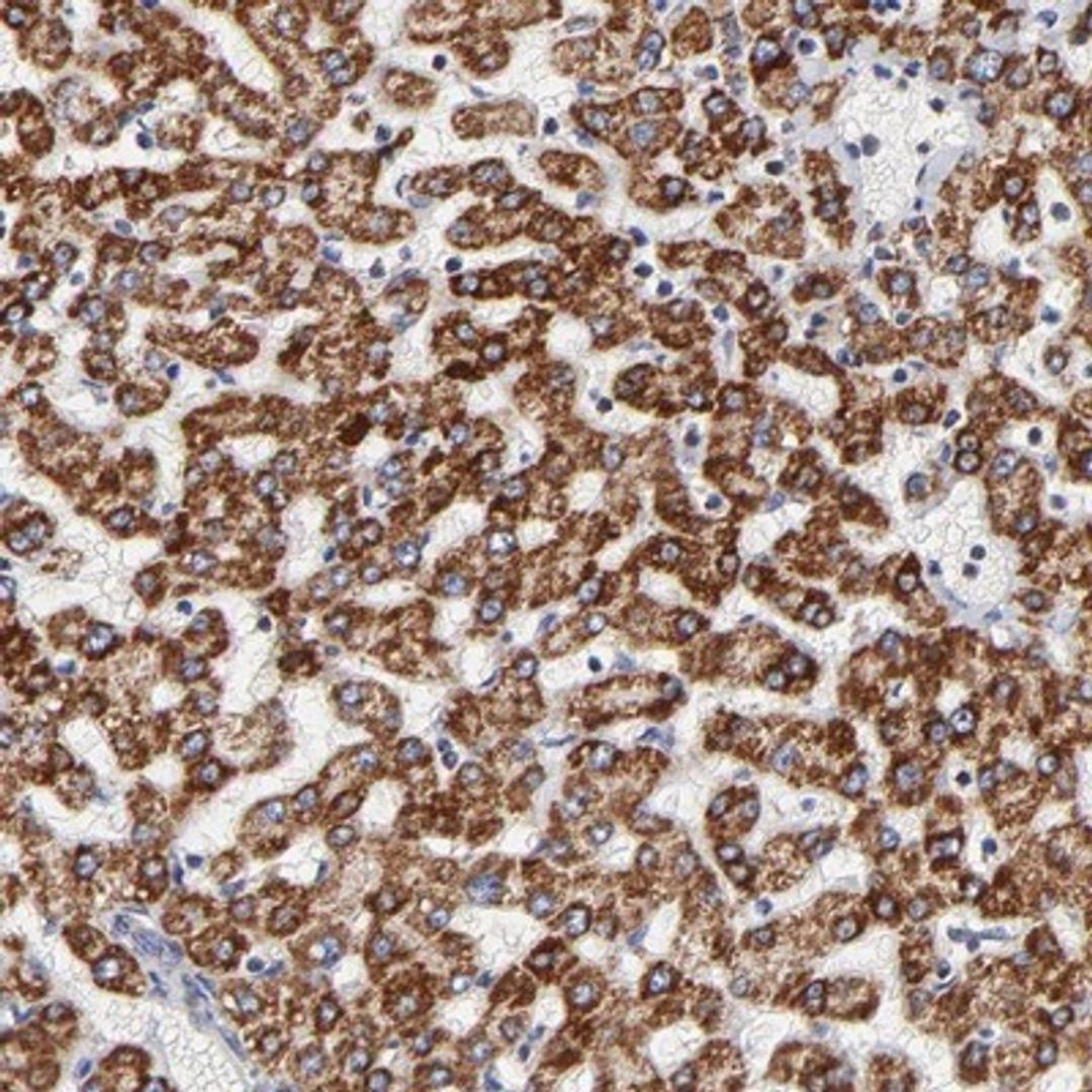 Immunohistochemistry-Paraffin: SDHB Antibody [NBP1-87069] - Staining of human liver shows strong cytoplasmic positivity in hepatocytes.