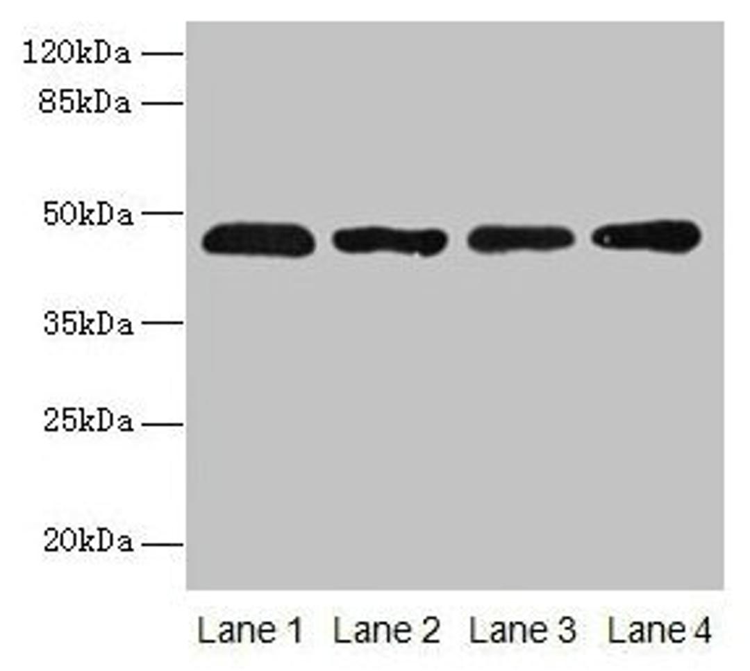 Western blot. All lanes: ZDHHC23 antibody at 8µg/ml. Lane 1: 293T whole cell lysate. Lane 2: Mouse brain tissue. Lane 3: A549 whole cell lysate. Lane 4: Human placenta tissue. Secondary. Goat polyclonal to rabbit IgG at 1/10000 dilution. Predicted band size: 46 kDa. Observed band size: 46 kDa