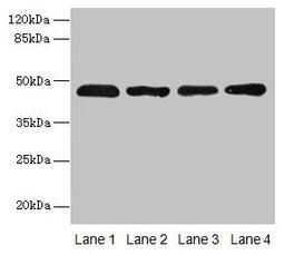 Western blot. All lanes: ZDHHC23 antibody at 8µg/ml. Lane 1: 293T whole cell lysate. Lane 2: Mouse brain tissue. Lane 3: A549 whole cell lysate. Lane 4: Human placenta tissue. Secondary. Goat polyclonal to rabbit IgG at 1/10000 dilution. Predicted band size: 46 kDa. Observed band size: 46 kDa
