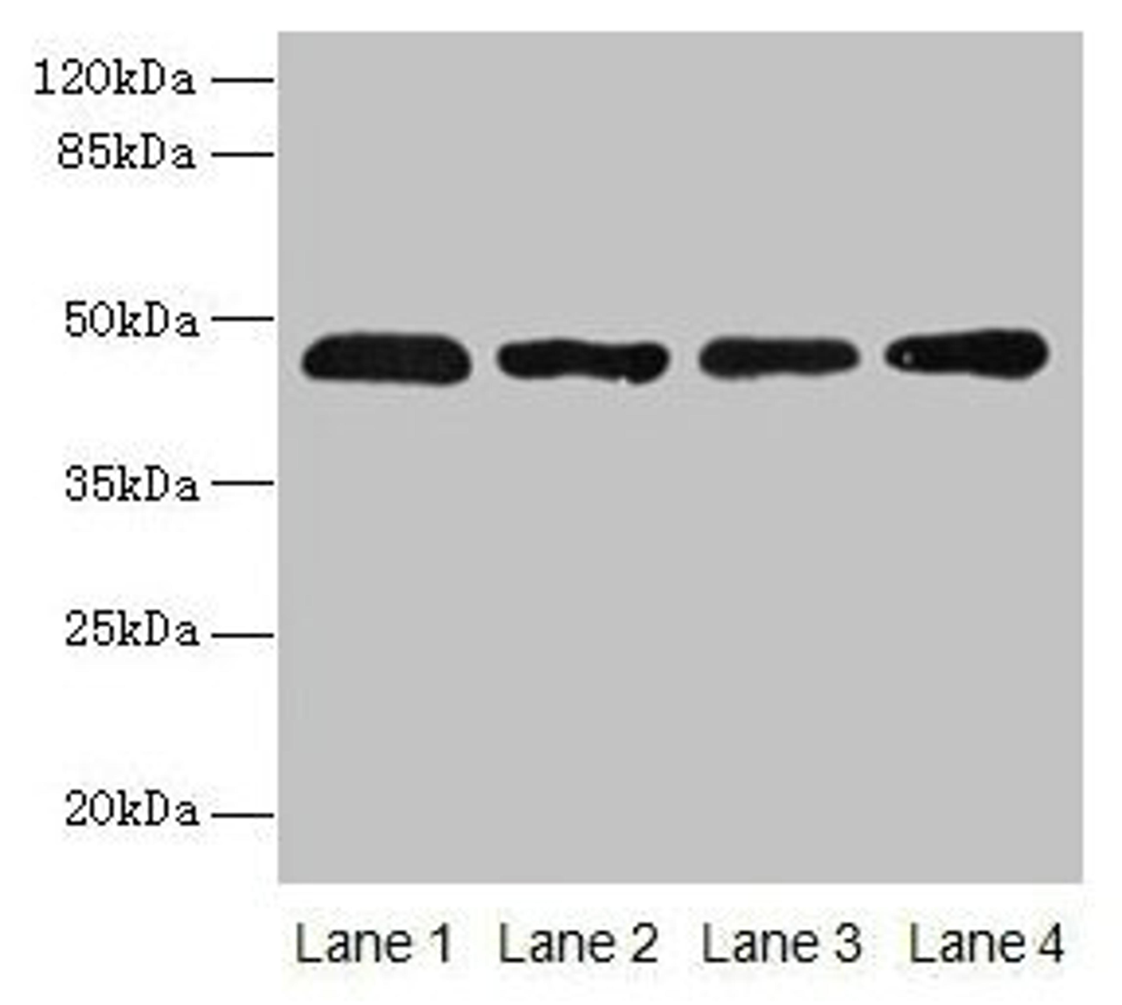 Western blot. All lanes: ZDHHC23 antibody at 8µg/ml. Lane 1: 293T whole cell lysate. Lane 2: Mouse brain tissue. Lane 3: A549 whole cell lysate. Lane 4: Human placenta tissue. Secondary. Goat polyclonal to rabbit IgG at 1/10000 dilution. Predicted band size: 46 kDa. Observed band size: 46 kDa