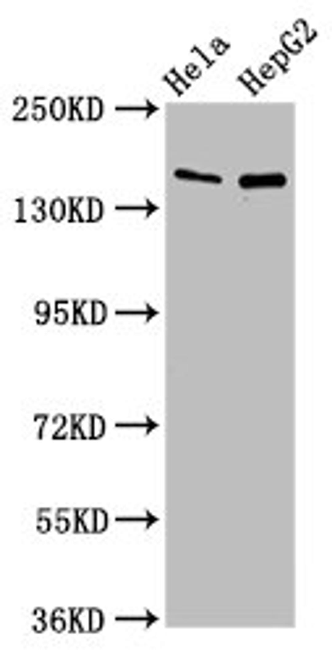Western Blot. Positive WB detected in: Hela whole cell lysate, HepG2 whole cell lysate. All lanes: SULF1 antibody at 4ug/ml. Secondary. Goat polyclonal to rabbit IgG at 1/50000 dilution. Predicted band size: 102 kDa. Observed band size: 150 kDa.