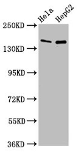 Western Blot. Positive WB detected in: Hela whole cell lysate, HepG2 whole cell lysate. All lanes: SULF1 antibody at 4ug/ml. Secondary. Goat polyclonal to rabbit IgG at 1/50000 dilution. Predicted band size: 102 kDa. Observed band size: 150 kDa.