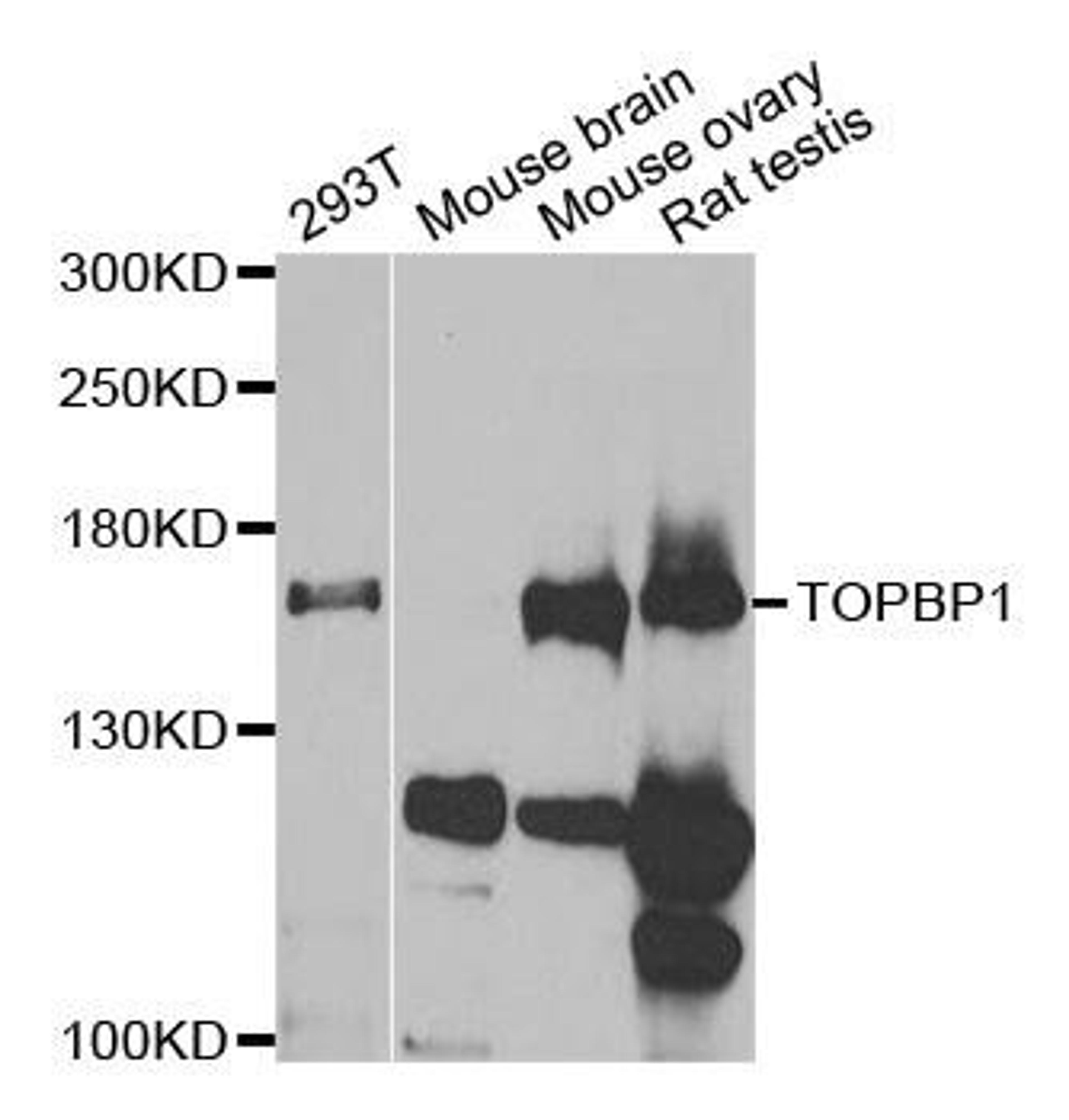 Western blot analysis of extracts of various cell lines using TOPBP1 antibody