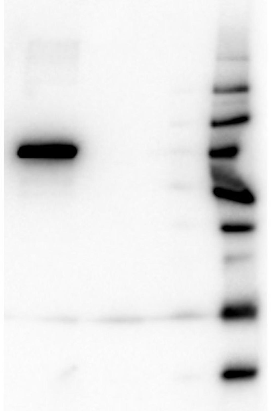 Western blot analysis of His-Tagged Recombinant using AKT ISOFORM antibody