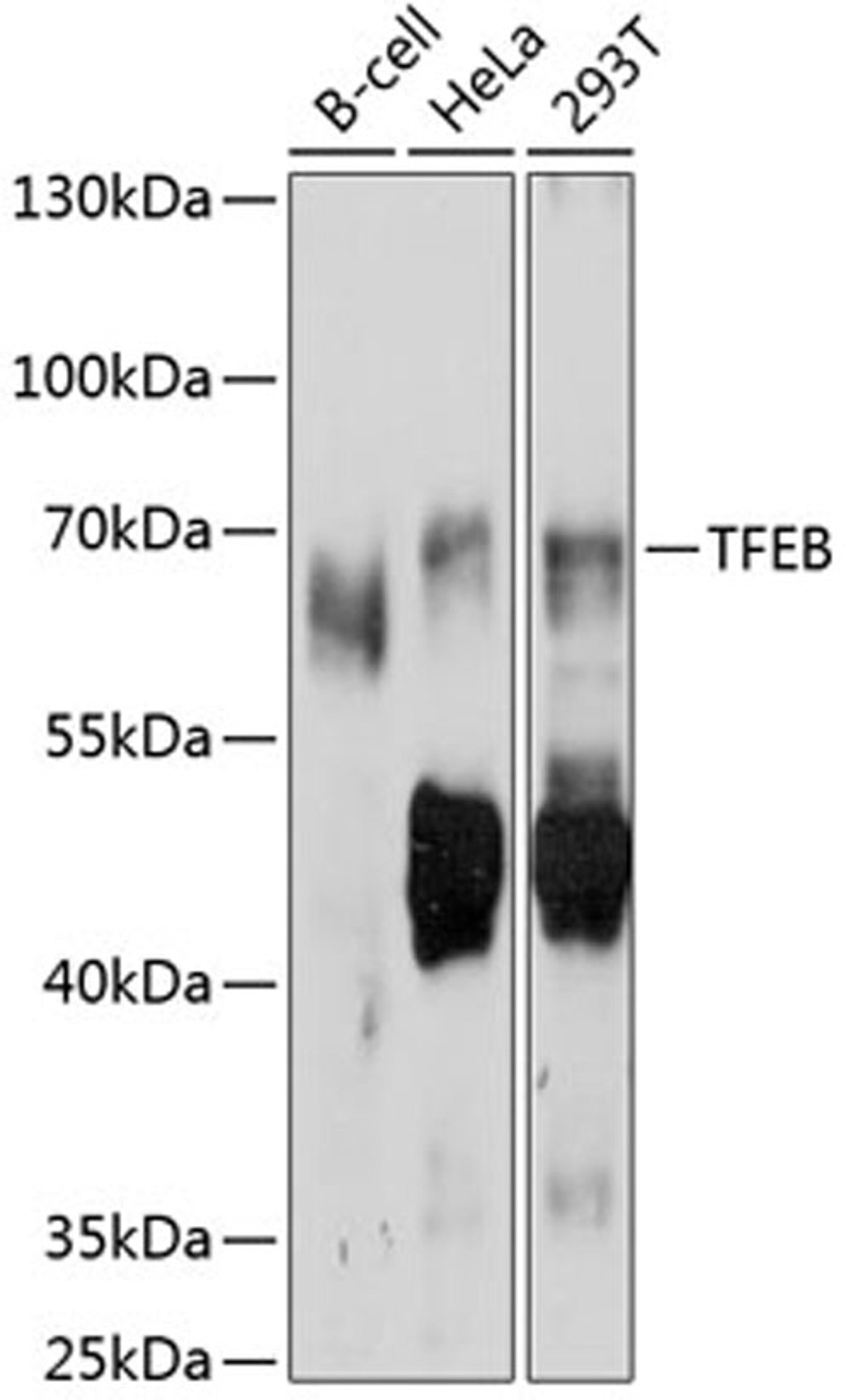 Western blot - TFEB antibody (A11796)