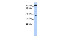 Antibody used in WB on Human HepG2 at 0.2-1 ug/ml.